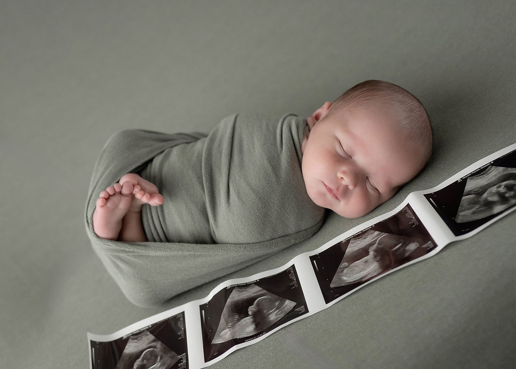 A newborn baby sleeps in a green swaddle next to his sonogram in a studio after using Baby Butler